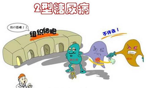2型糖尿病
